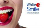 White&amp;Smile (Вайт-Смайл), Студия отбеливания зубов